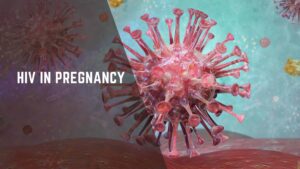 hiv in pregnancy
