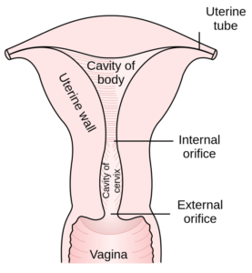cervix incompetence