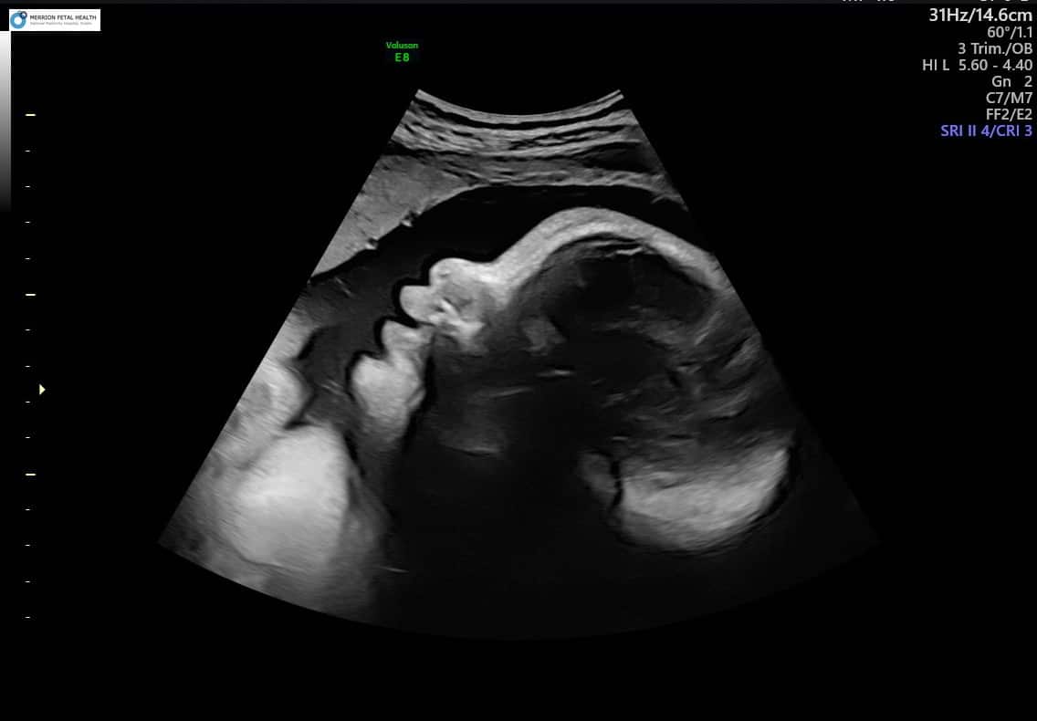 baby scan images Merrion Fetal Health Tricefy