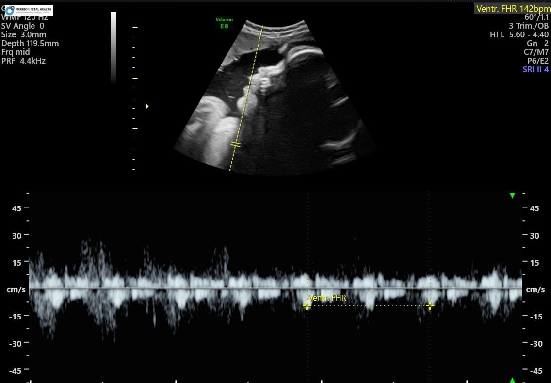 pregnancy scans images Merrion Fetal Health Tricefy-1