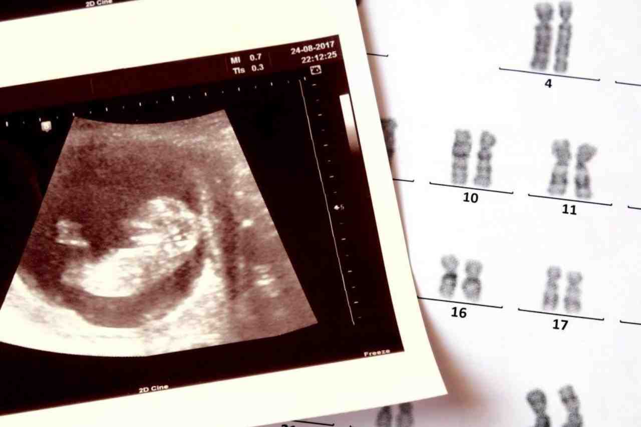 Is the ultrasound scan safe for both the mother and the baby 1